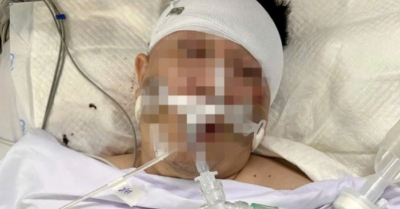 Luật sư lên tiếng vụ người đàn ông nguy kịch do tông phải chó chạy rông