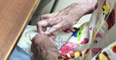 Thiếu nữ 17 tuổi bị bỏng nặng do keo nến, phải trải qua 15 lần phẫu thuật