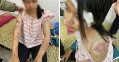 Bé gái 13 tuổi bị ông bà bạo hành đến mức nhập viện cấp cứu