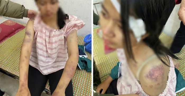 bạo hành trẻ em Linh Sơn Thái Nguyên