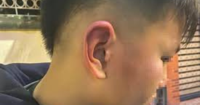 Công an điều tra bé trai 12 tuổi bị hành hung