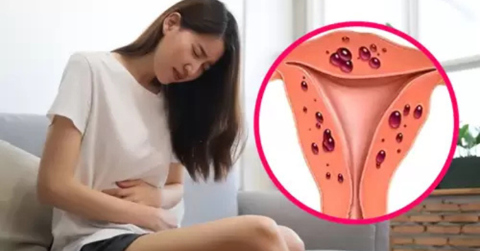 Ung thư cổ tử cung: AI tầm soát sớm