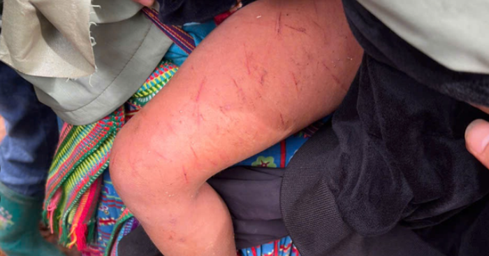 Đêm mưa rét kinh hoàng của bé 4 tuổi lạc trong rừng cao su ở Lai Châu