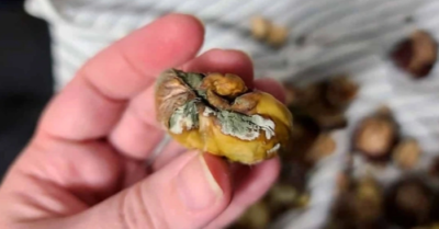 Ung thư dạ dày vì thực phẩm để tủ lạnh: Cô gái 27 tuổi ở Trung Quốc trả giá đắt cho thói quen tiết kiệm