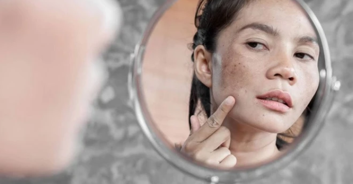 Sắc mặt không chỉ nói lên vẻ ngoài mà còn phản ánh sức khỏe tạng phủ. Những thay đổi như vàng vọt, tối xám hay sạm đen là dấu hiệu cơ thể đang suy yếu và cần được chú ý