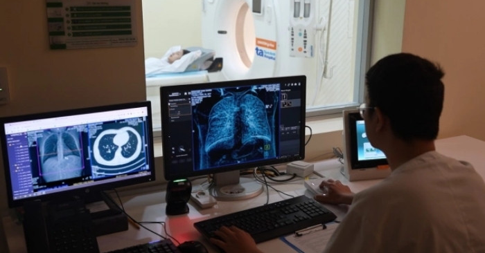 Ô nhiễm không khí, đặc biệt bụi mịn PM2.5, được chuyên gia cảnh báo là tác nhân ung thư nguy hiểm khi có thể xuyên sâu vào phổi, gây viêm kéo dài và đột biến DNA