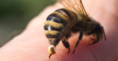 Cứu sống bệnh nhân bị ong vò vẽ đốt gây sốc phản vệ độ II