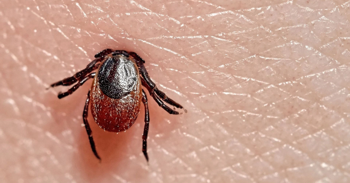 Suýt chết vì nhiễm virus từ giường của người mẹ quá cố