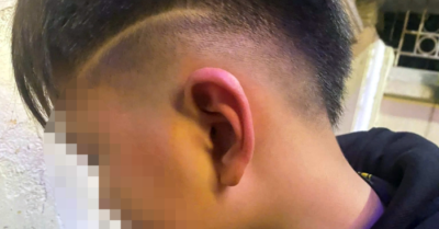 Công an điều tra bé trai 12 tuổi nghi bị bố bạn học hành hung