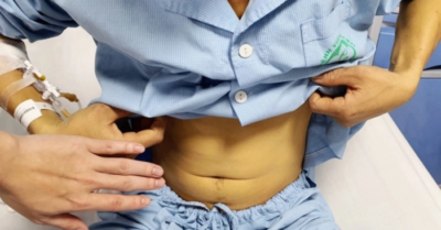 Suýt chết vì nuốt mật cá trắm để “tăng cường sinh lực”