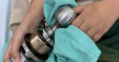 Bé trai kẹt ngón tay ở ổ khóa, bác sĩ hóa “thợ sửa khóa” cấp cứu thành công