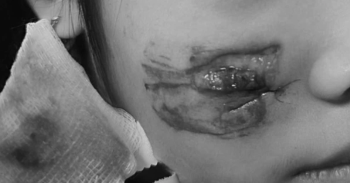 Khỉ hoang tấn công rách mặt bé gái 7 tuổi ở Quảng Bình