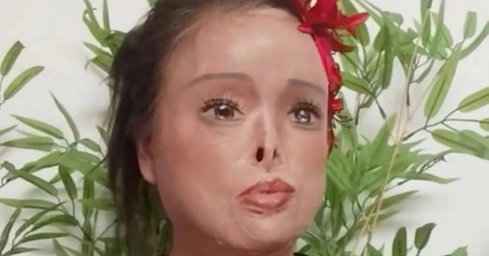 Bị chồng cũ tạt axit: Người phụ nữ Trung Quốc vẽ lại gương mặt