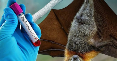Bộ Y tế phát lệnh khẩn, siết phòng dịch Nipah nguy hiểm chết người