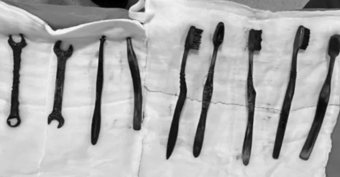 Bác sĩ lấy 2 cờ lê sắt