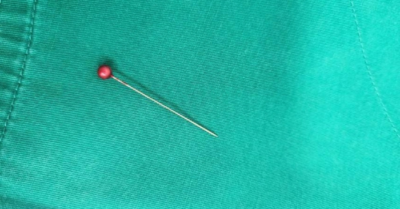 Kim may đâm sâu vào phế quản: Bé trai 13 tháng tuổi nguy kịch vì hóc dị vật đường thở