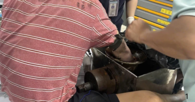 Tai nạn lao động nghiêm trọng: Công nhân bị máy xay thịt cuốn nát bàn tay trái