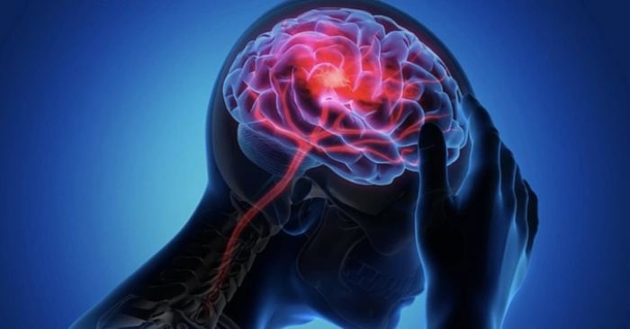 Ba thời điểm dễ gây đột quỵ cần cảnh giác mùa lạnh