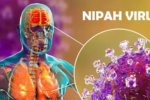 Bộ Ngoại giao: Việt Nam chưa ghi nhận ca mắc virus Nipah