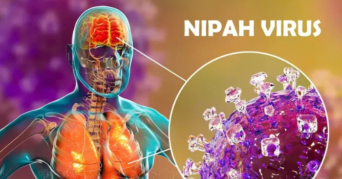 Bộ Ngoại giao: Việt Nam chưa ghi nhận ca mắc virus Nipah