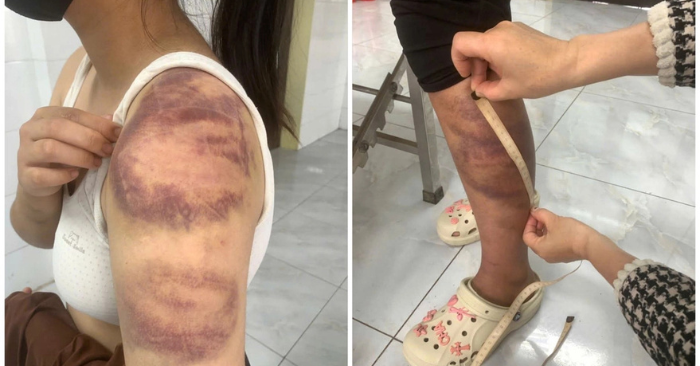 Cha đánh con gái 13 tuổi – Tạm giữ người cha đánh con gái, hành hạ vợ bầu ở Bắc Ninh