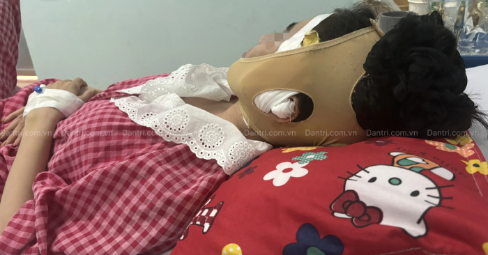 Sau tiêm filler, cô gái biến dạng mặt - Spa đóng cửa