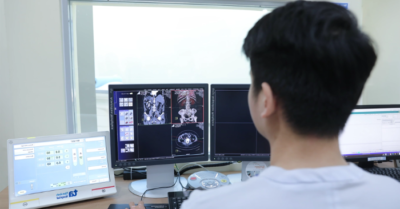 Ung thư não: phát hiện bệnh từ dấu hiệu nhầm với tiền mãn kinh