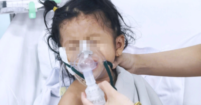 Cả nước ghi nhận 26.000 ca tay chân miệng, Bộ Y tế cảnh báo chủng EV71 diễn biến nặng