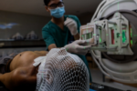 Ung thư tại Việt Nam và thách thức từ việc phát hiện muộn