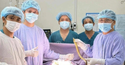 Phẫu thuật lấy con lươn dài 50cm trong bụng nam bệnh nhân tại Đồng Nai