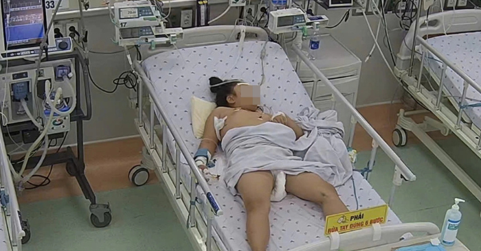 sốt xuất huyết Dengue nặng