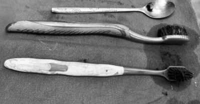 Bác sĩ Việt Đức mổ dạ dày lấy hai bàn chải và thìa inox