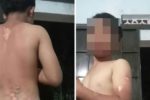 Công an xác minh bé trai ở Đắk Lắk nghi bị mẹ tạt nước sôi