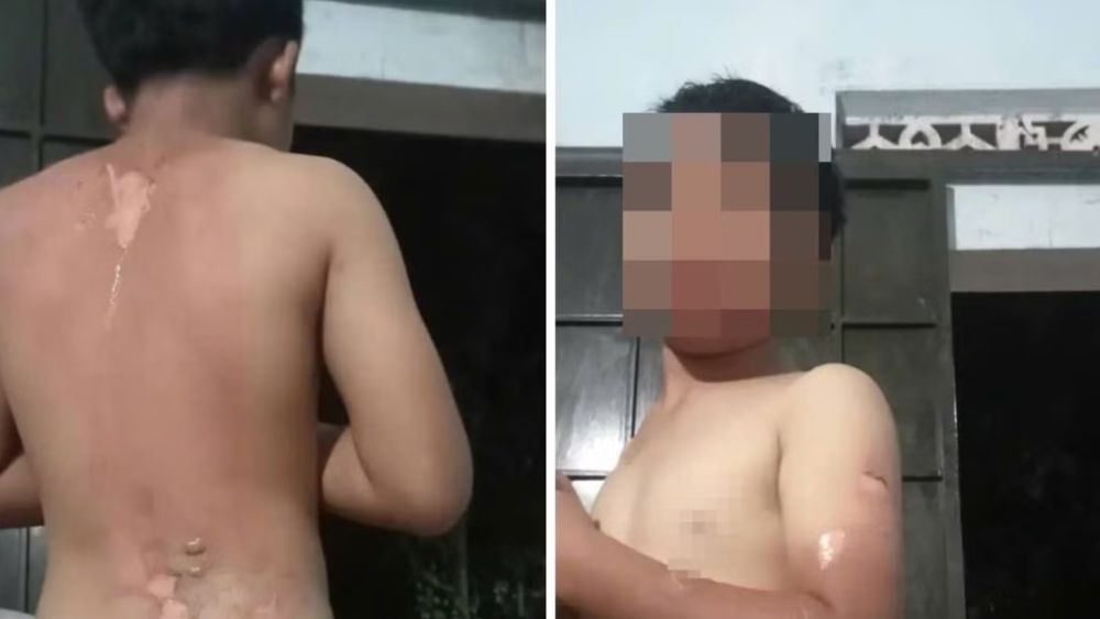 Công an xác minh vụ bé trai ở Đắk Lắk nghi bị mẹ tạt nước sôi gây bỏng. Diễn biến vụ việc đang thu hút sự quan tâm của dư luận.