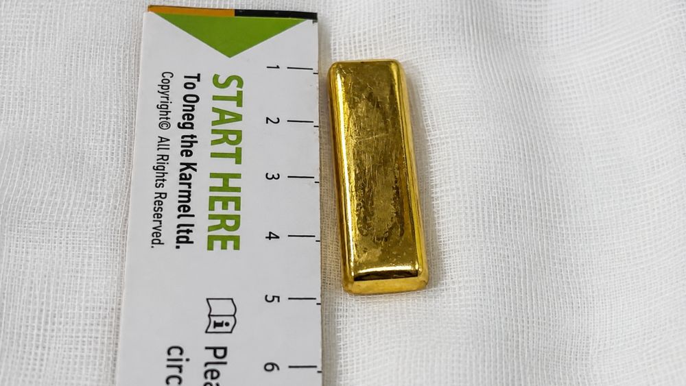 Bé gái 5 tuổi nhập viện sau khi nuốt thỏi vàng 50 g. Dị vật được bác sĩ gắp ra khỏi dạ dày, bé hồi phục tốt.