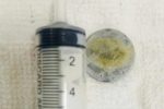 Bé gái 5 tuổi ở Thái nguyên nuốt pin cúc áo, thoát hiểm trong gang tấc